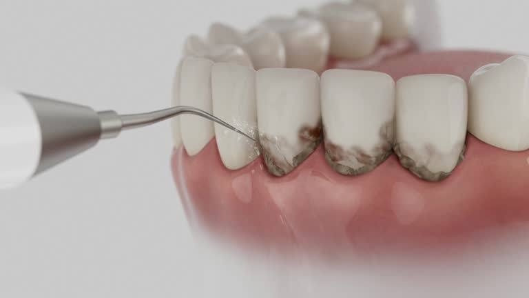 Reliable Root Canal Treatment contractor in Harnett County County, NC by Dentist Open Now